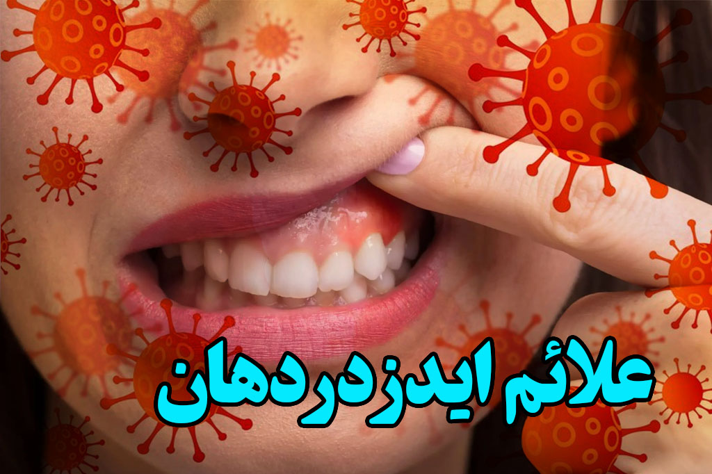 علامتhiv دردهان