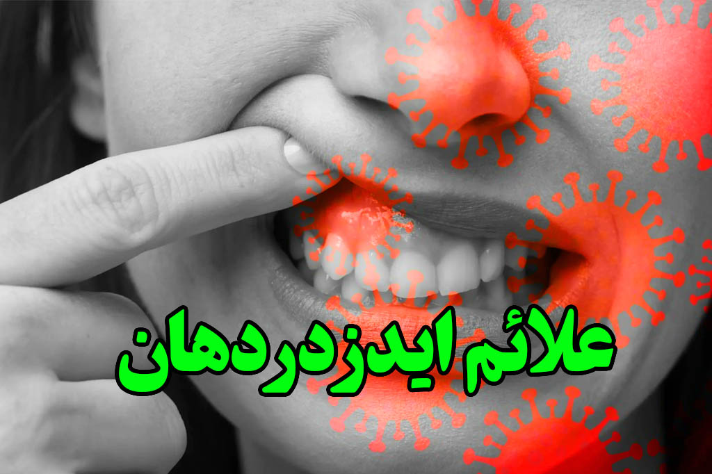 علایم ایدز در دهان