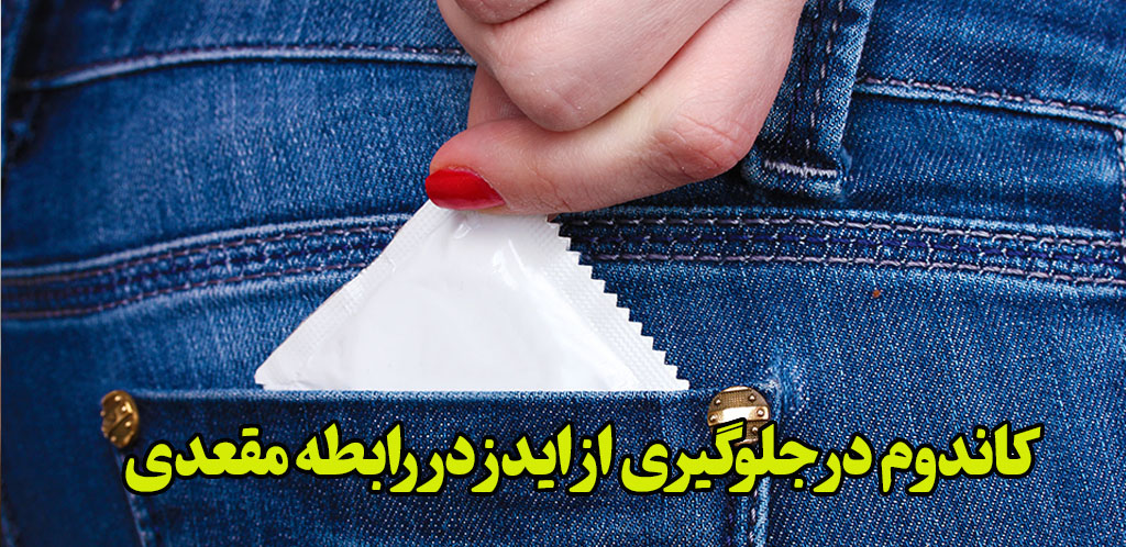 کاندوم رابطه مقعدی و ایدز