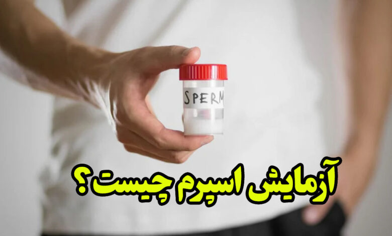 آزمایش اسپرم