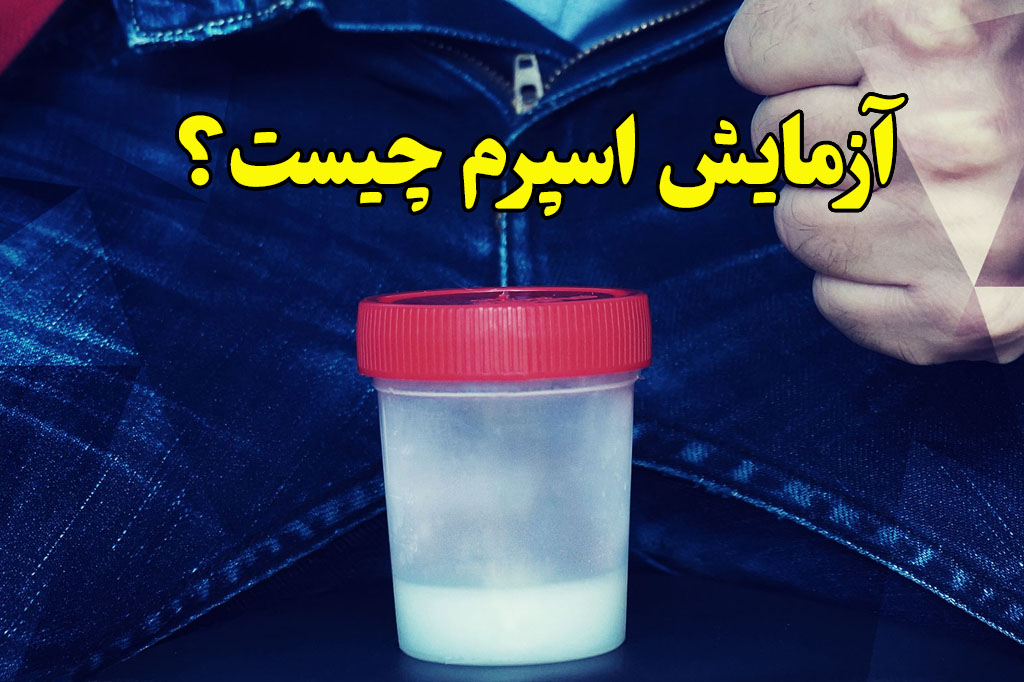 ازمایش اسپرم چیه