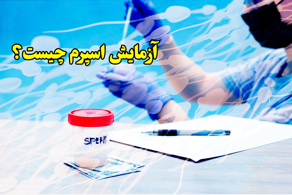 اسپرم ازمایش چیست