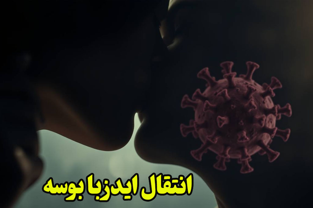 انتقال ایدز با بوسه فرانسوی