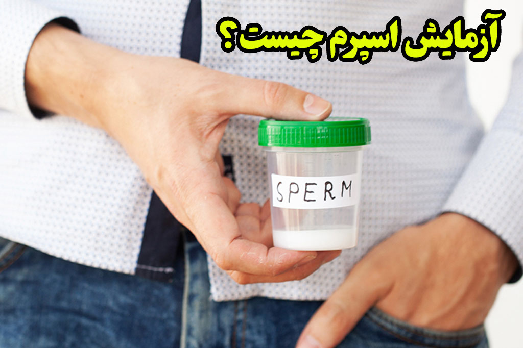 تست اسپرم چیست