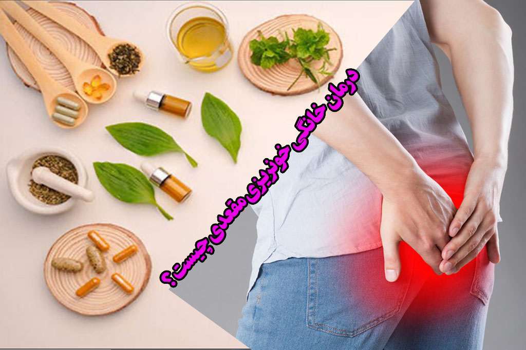 درخانه درمان خونریزی مقعد