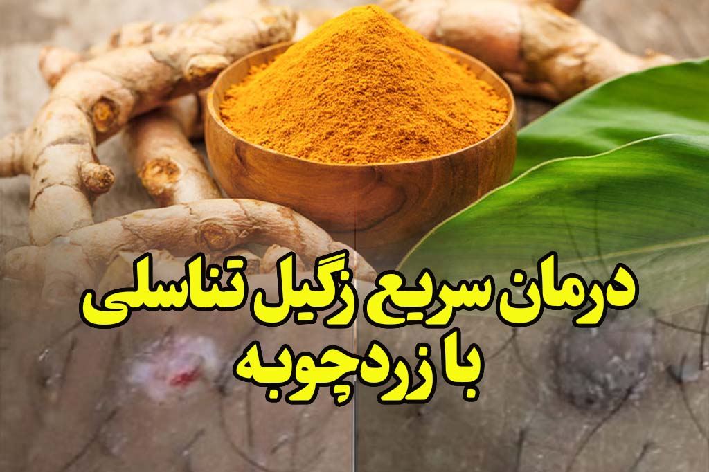 درمان سریع زگیل تناسلی