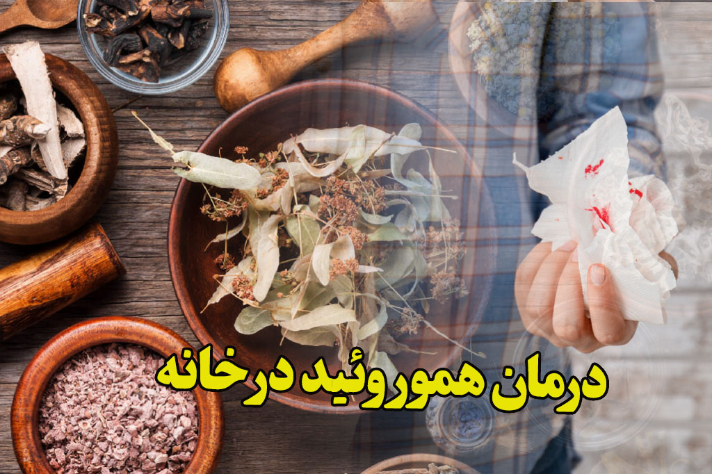 درمان هموروئید در خانه