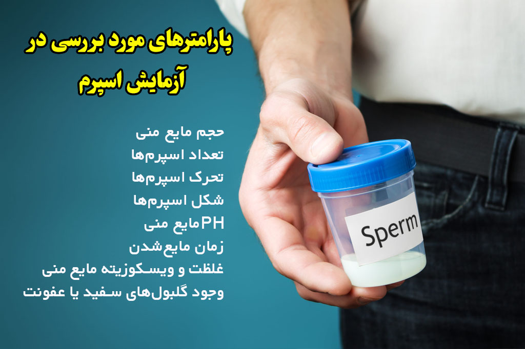 موارد بررسی تست اسپرم