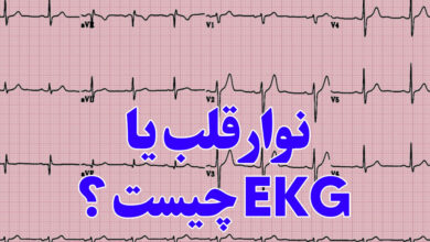 ekg چیست