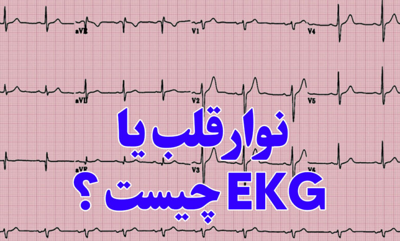 ekg چیست