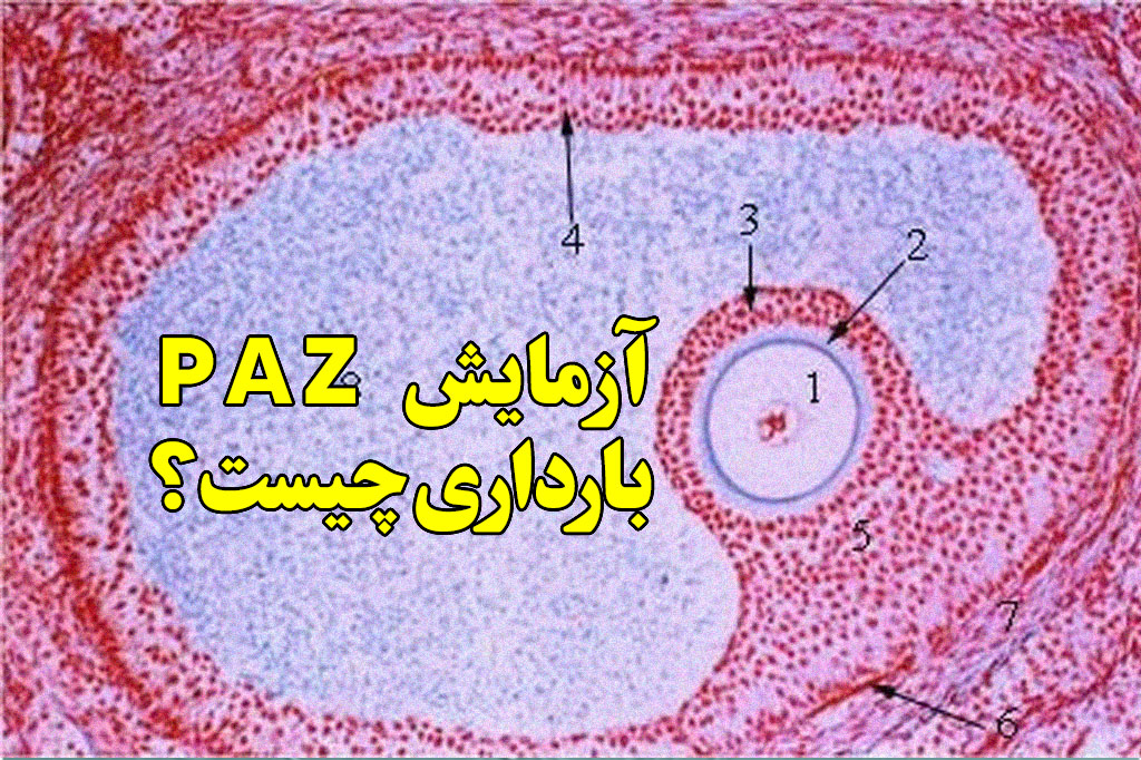 ازمایش pza بارداری