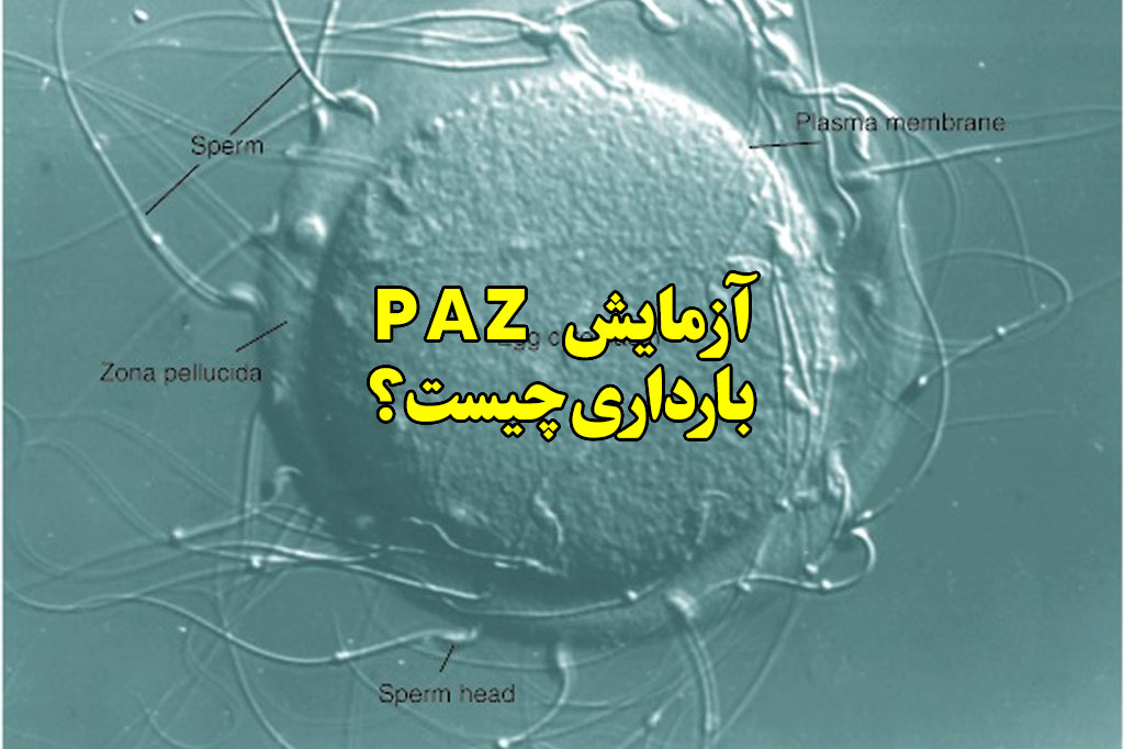 ازمایش paz بارداری