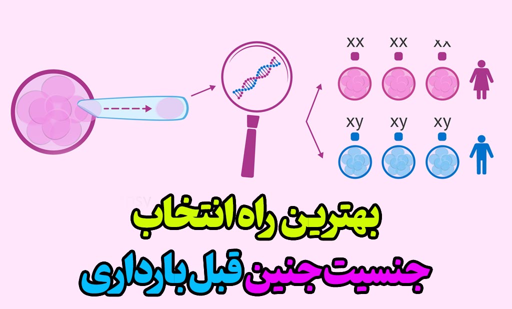 انتخاب جنسیت جنین قبل بارداری