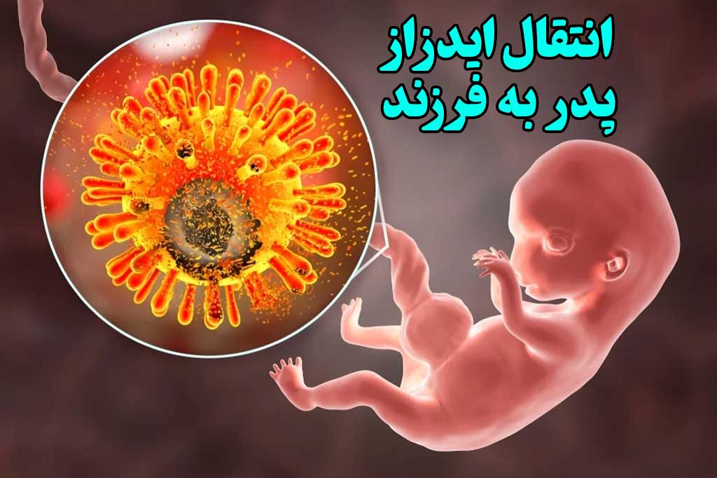 انتقال hiv از پدر به پسر