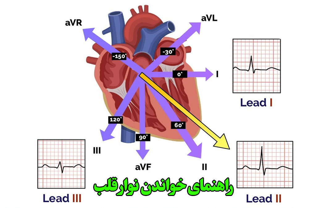 تفسیر نوار قلب