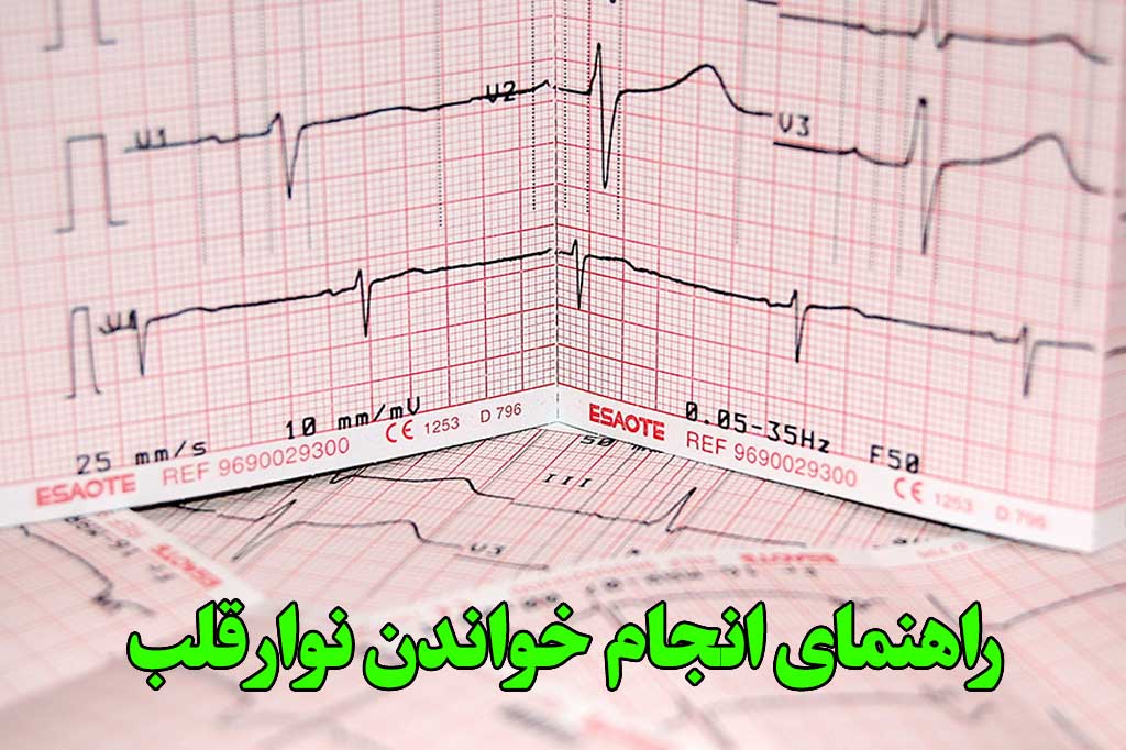 خواندن نوار قلب به زبان ساده