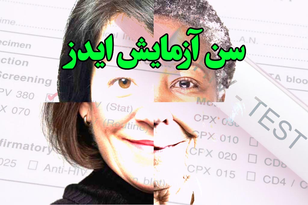 سن آزمایش ایدز
