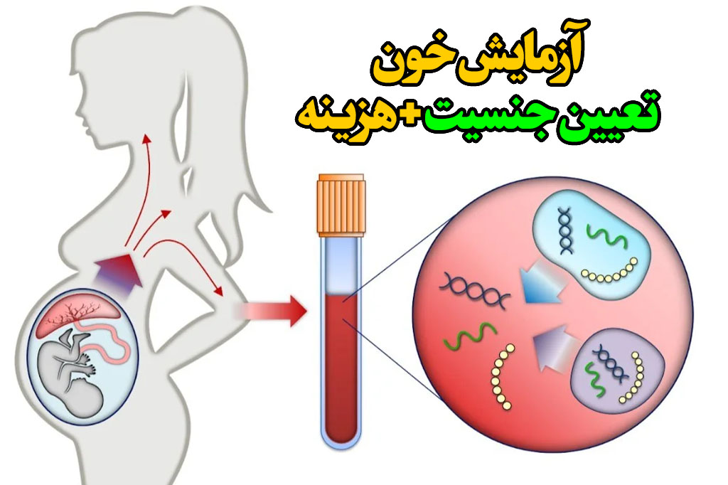 تست خون تعیین جنسیت