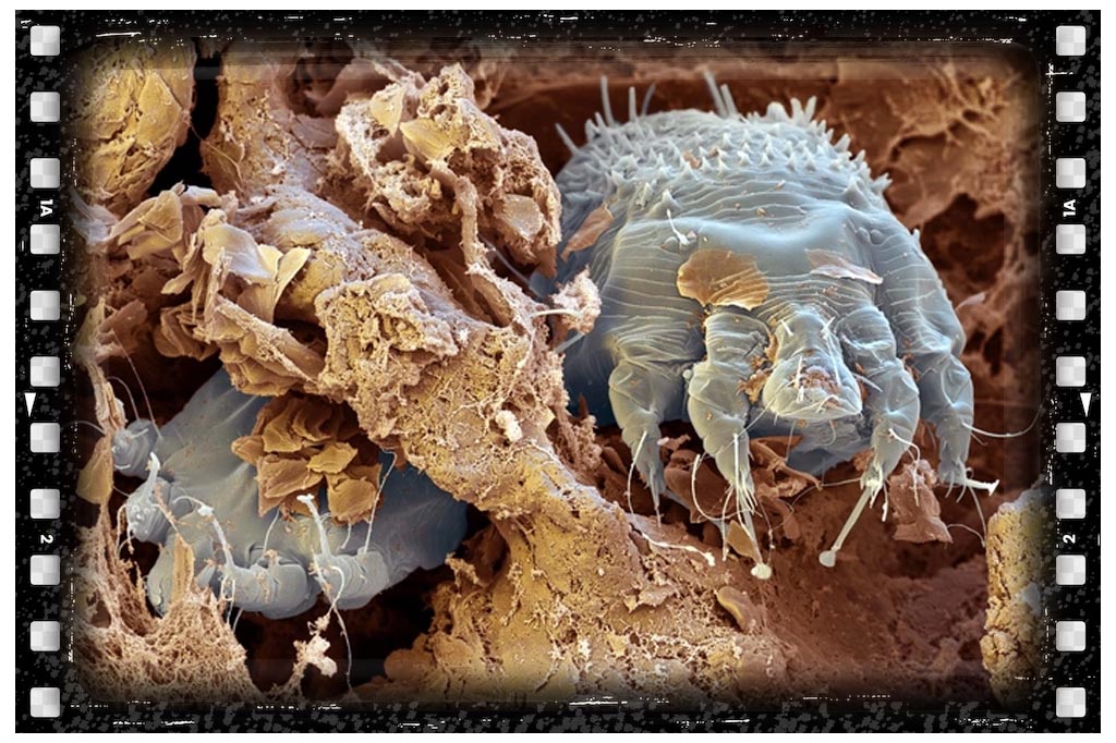 جای نیش حشرات گال