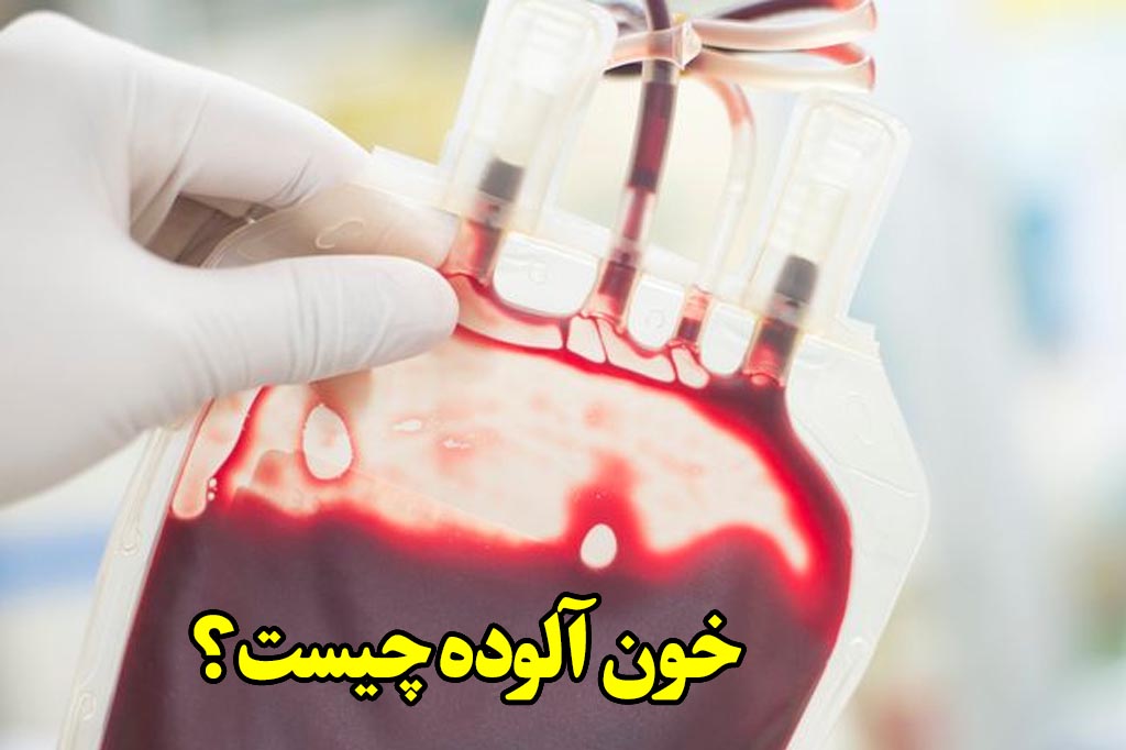 خون الوده چیست