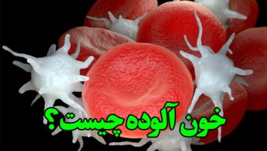 خون آلوده چیست