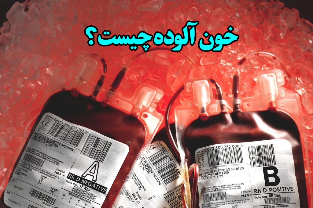 خون الوده چیست