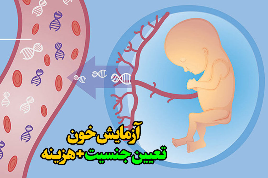 آزمایش خون تعیین جنسیت درسته ؟