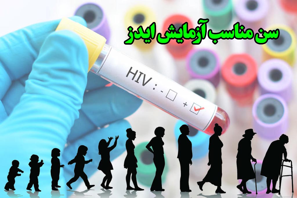 سن تست hiv