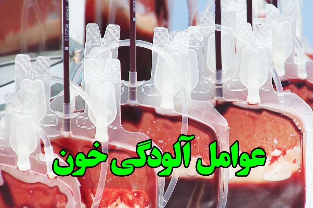 عوامل الودگی خون