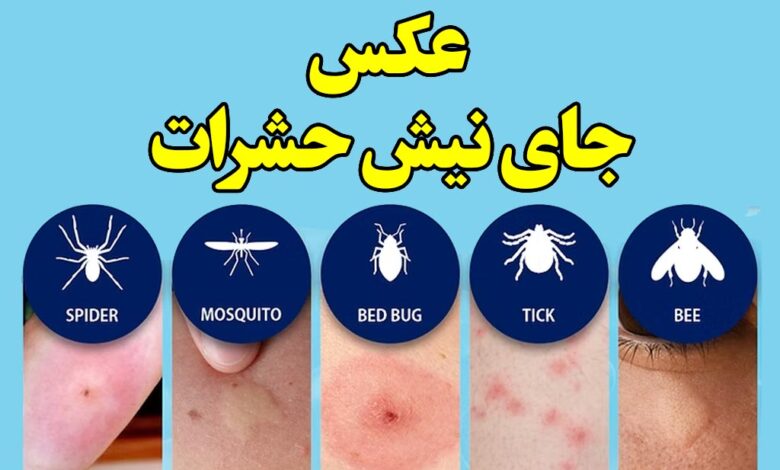 عکس جای نیش حشرات