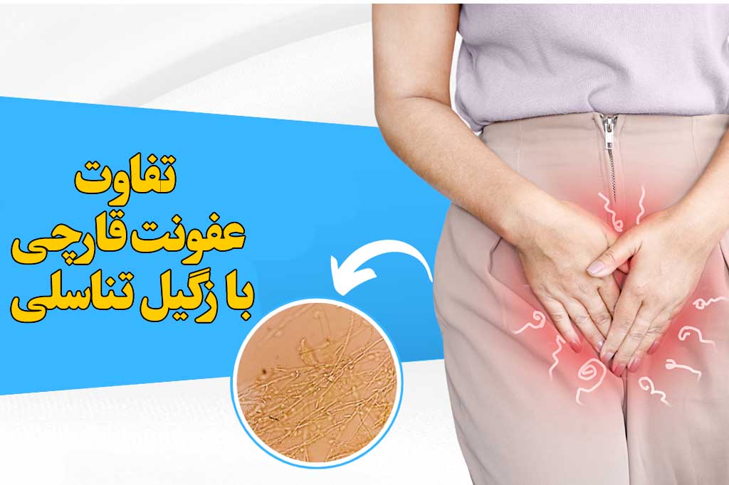 فرق زگیل تناسلی با عفونت