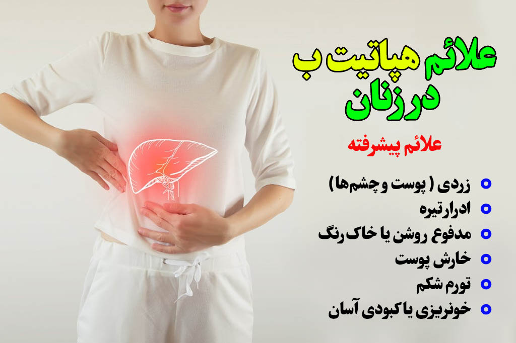 علاپم پیشرفته هپاتیت در زنان