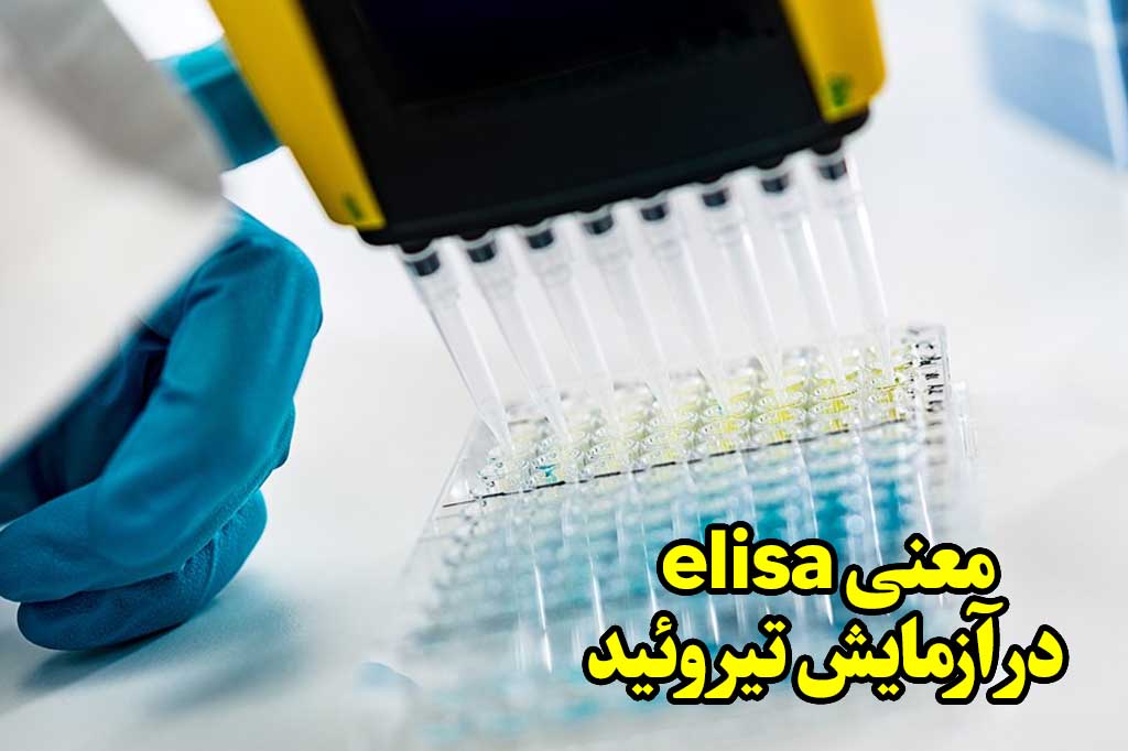 معنی elisa در آزمایش تیروئید
