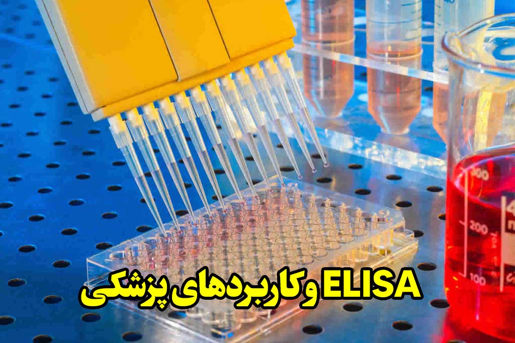 کاربردهای پزشکی آزمایش ELISA