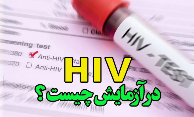 hiv در آزمایش چیست