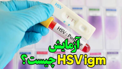 آزمایش hsv igm چیست