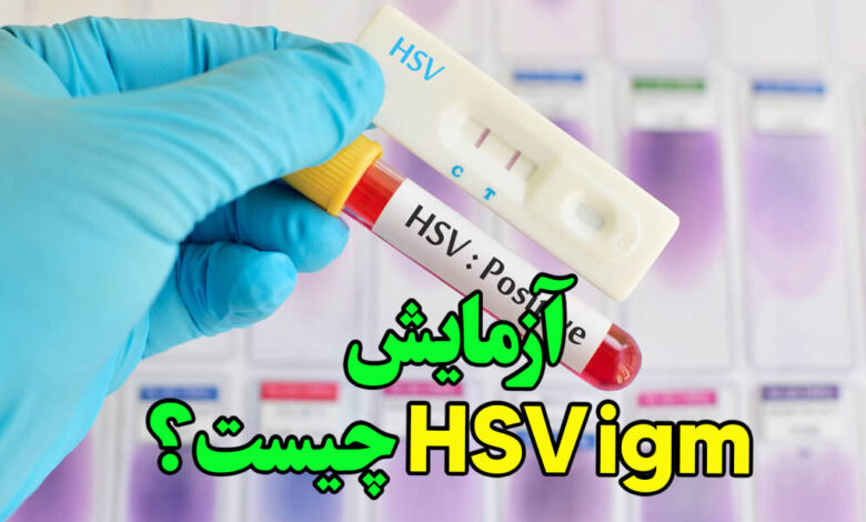 آزمایش hsv igm چیست