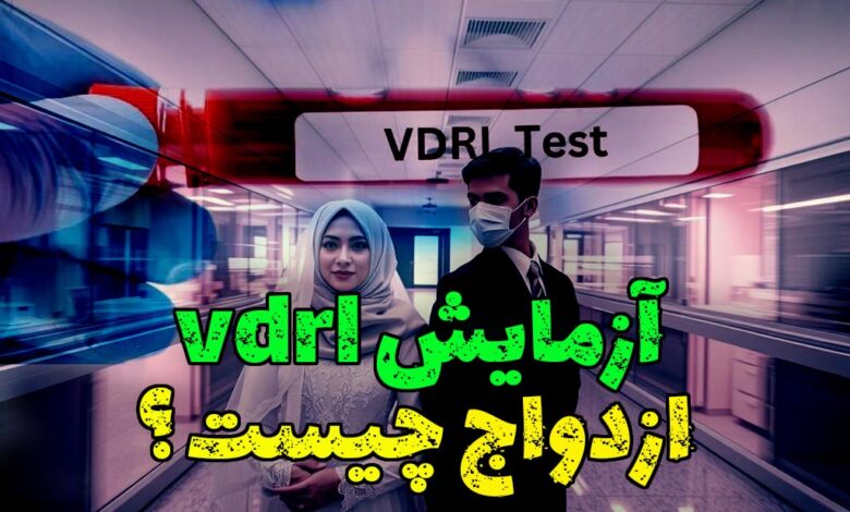 آزمایش vdrl ازدواج چیست