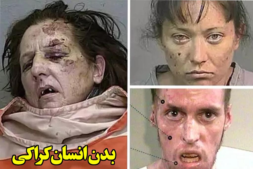 بدن انسان کراکی