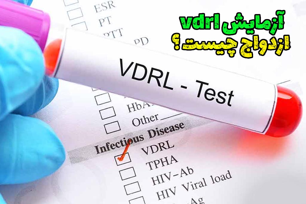 مدت آزمایش vdrl ازدواج