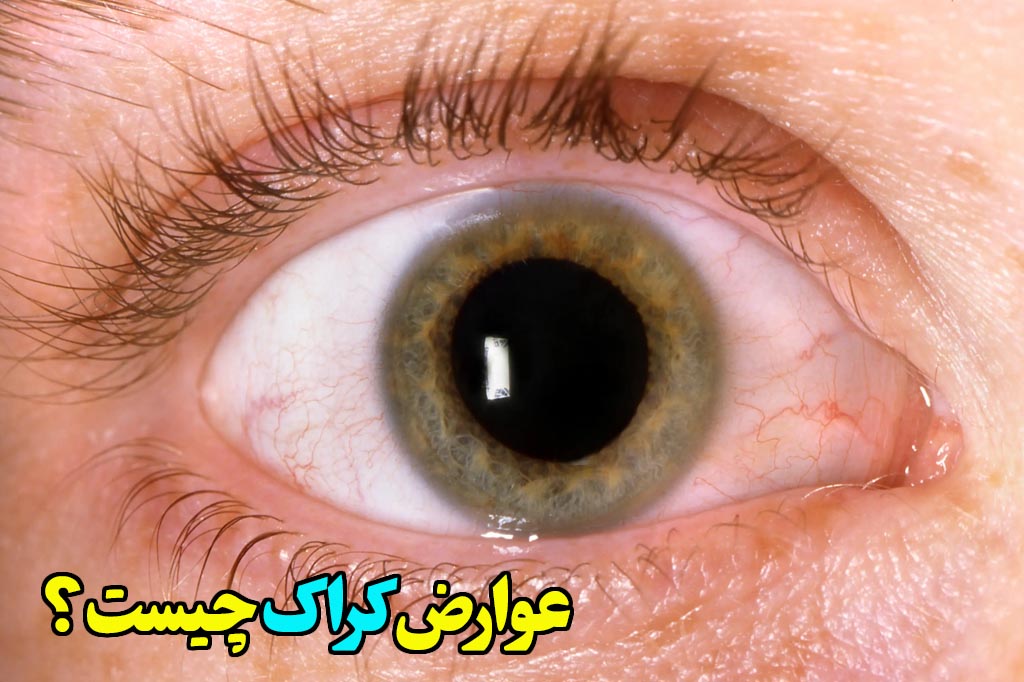 عوارض اعتیاد به کراک