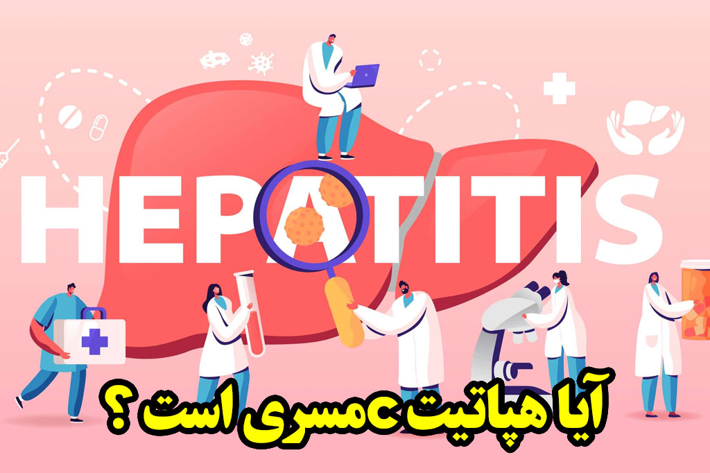 هپاتیت C مسری است