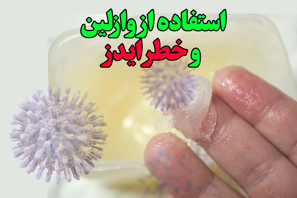 وازلین و ایدز