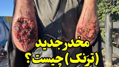 تِرَنک چیست