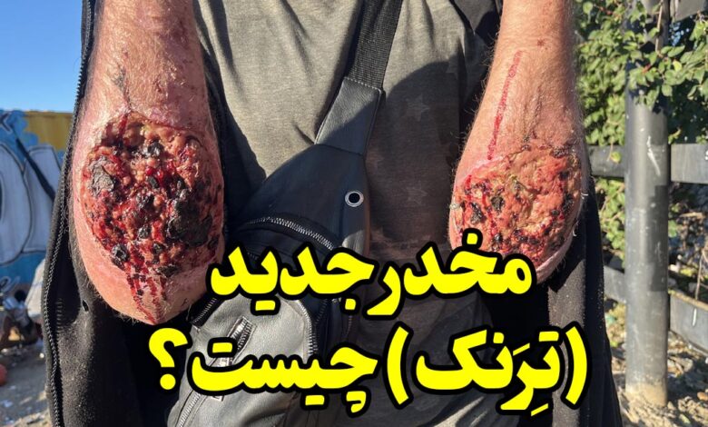 تِرَنک چیست