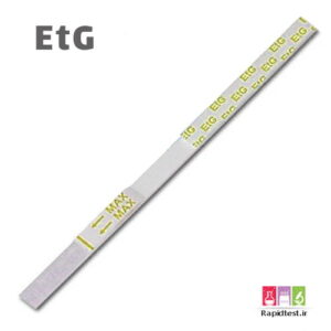 کیت الکل در ادرار