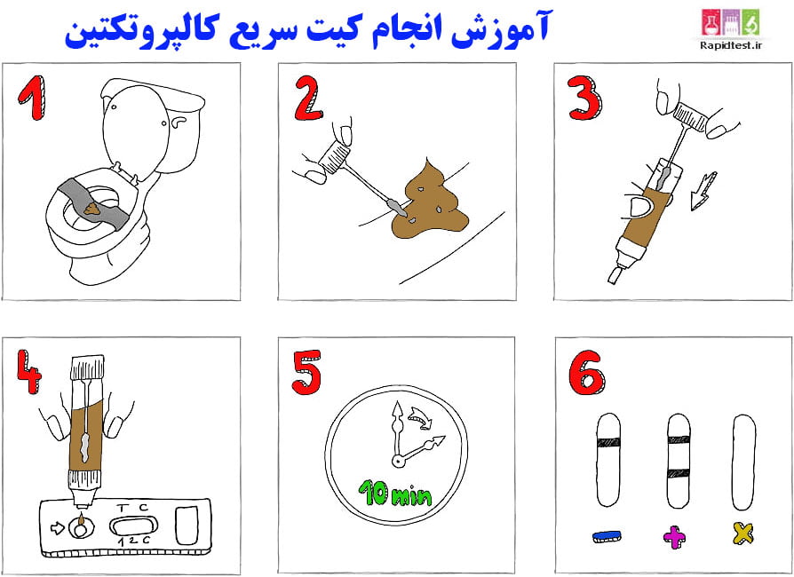 روش تست کالپروتکتین