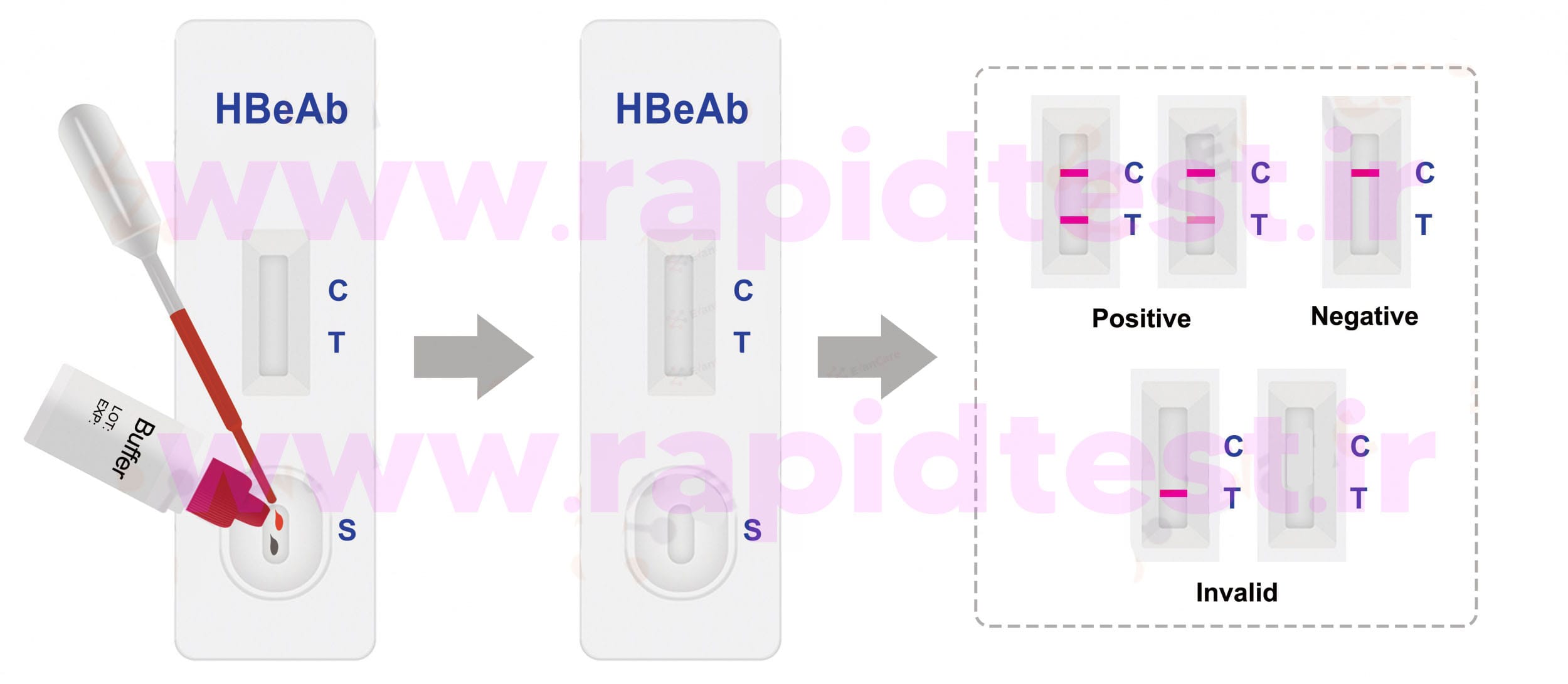 کامل انجام آزمایش سریع HBeAb